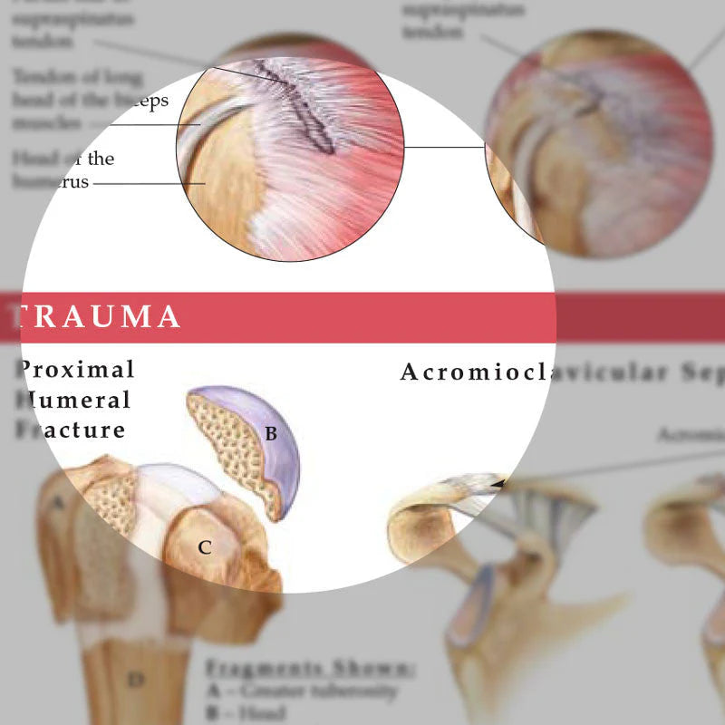 Anatomy and Injuries of the Shoulder