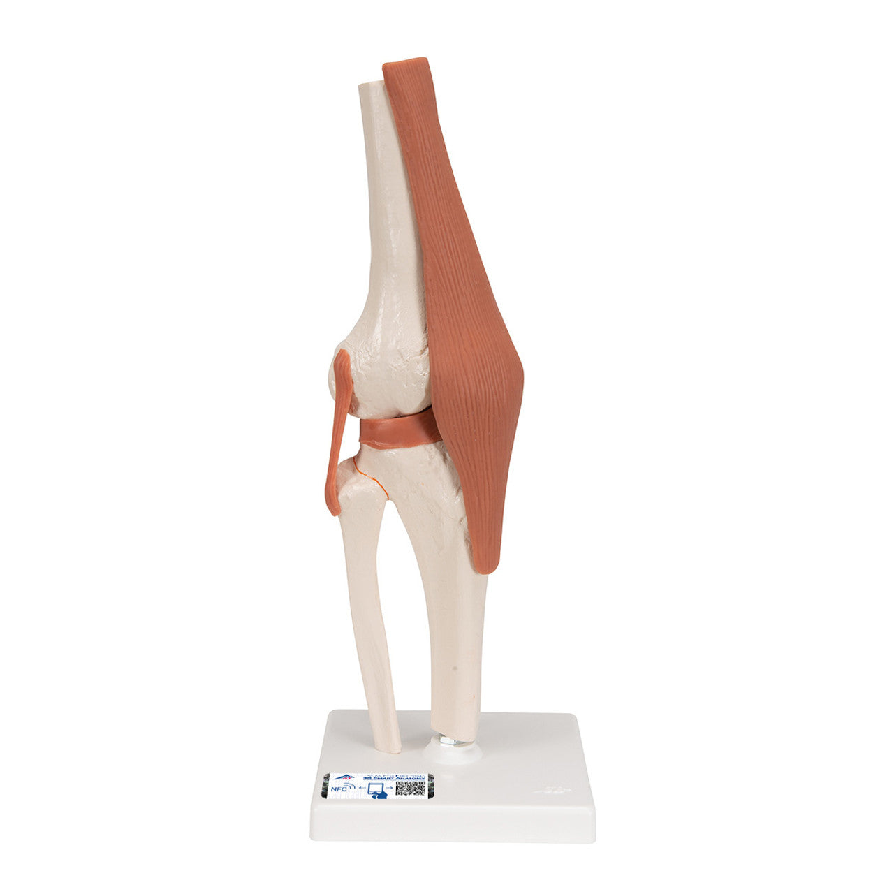 FUNCTIONAL KNEE JOINT