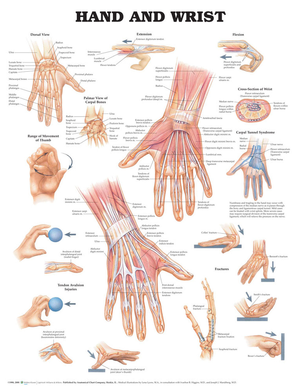 Hand and Wrist (Laminated) - physio supplies canada